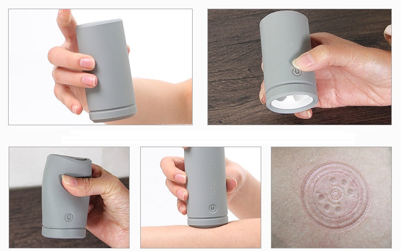 Electric Silicone Cupping Therapy Equipment 