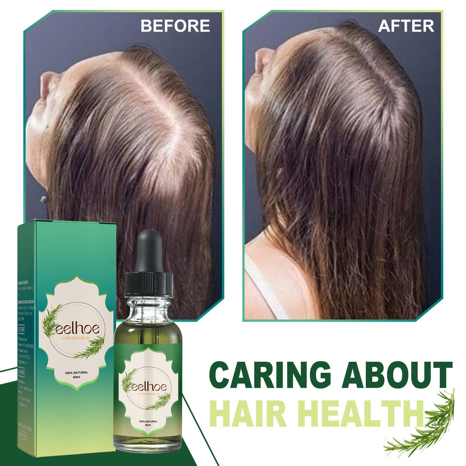 hair loss treatment