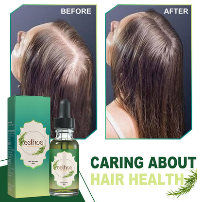 hair loss treatment